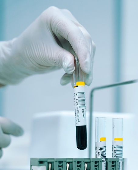 blood sample
